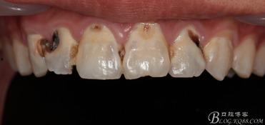 颗牙齿图片,探索口腔健康的视觉盛宴